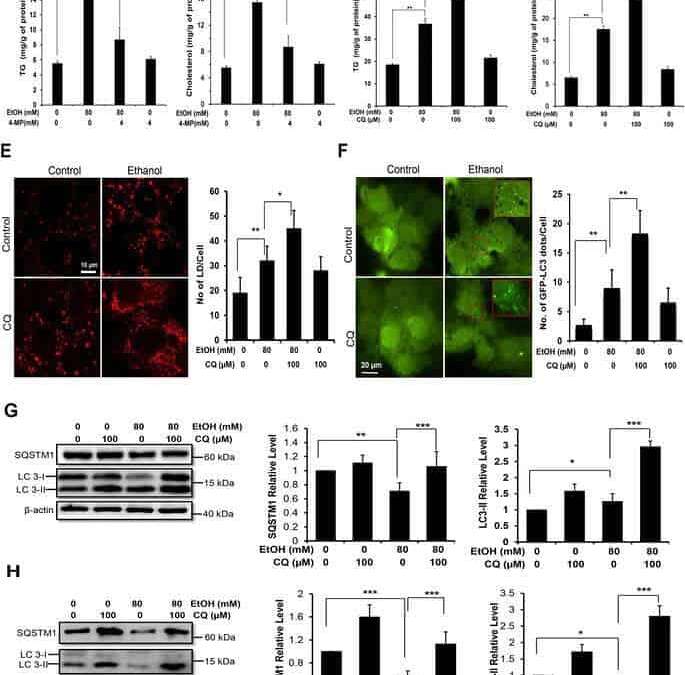 Ethanol-triggered Lipophagy Requires SQSTM1 in AML12 Hepatic Cells