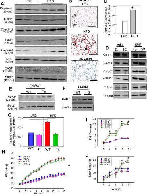Calpain Inhibition Attenuates Adipose Tissue Inflammation and Fibrosis in Diet-induced Obese Mice