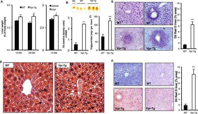 HIV-1 viral protein R (Vpr) induces fatty liver in mice via LXRα and PPARα dysregulation: implications for HIV-specific pathogenesis of NAFLD