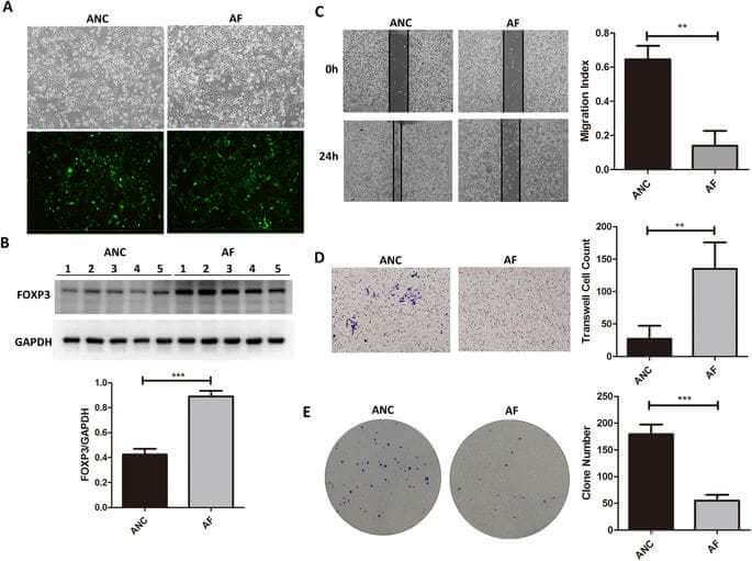 Quantitative proteomic Analysis Reveals up-regulation of caveolin-1 in FOXP3-overexpressed human gastric cancer cells