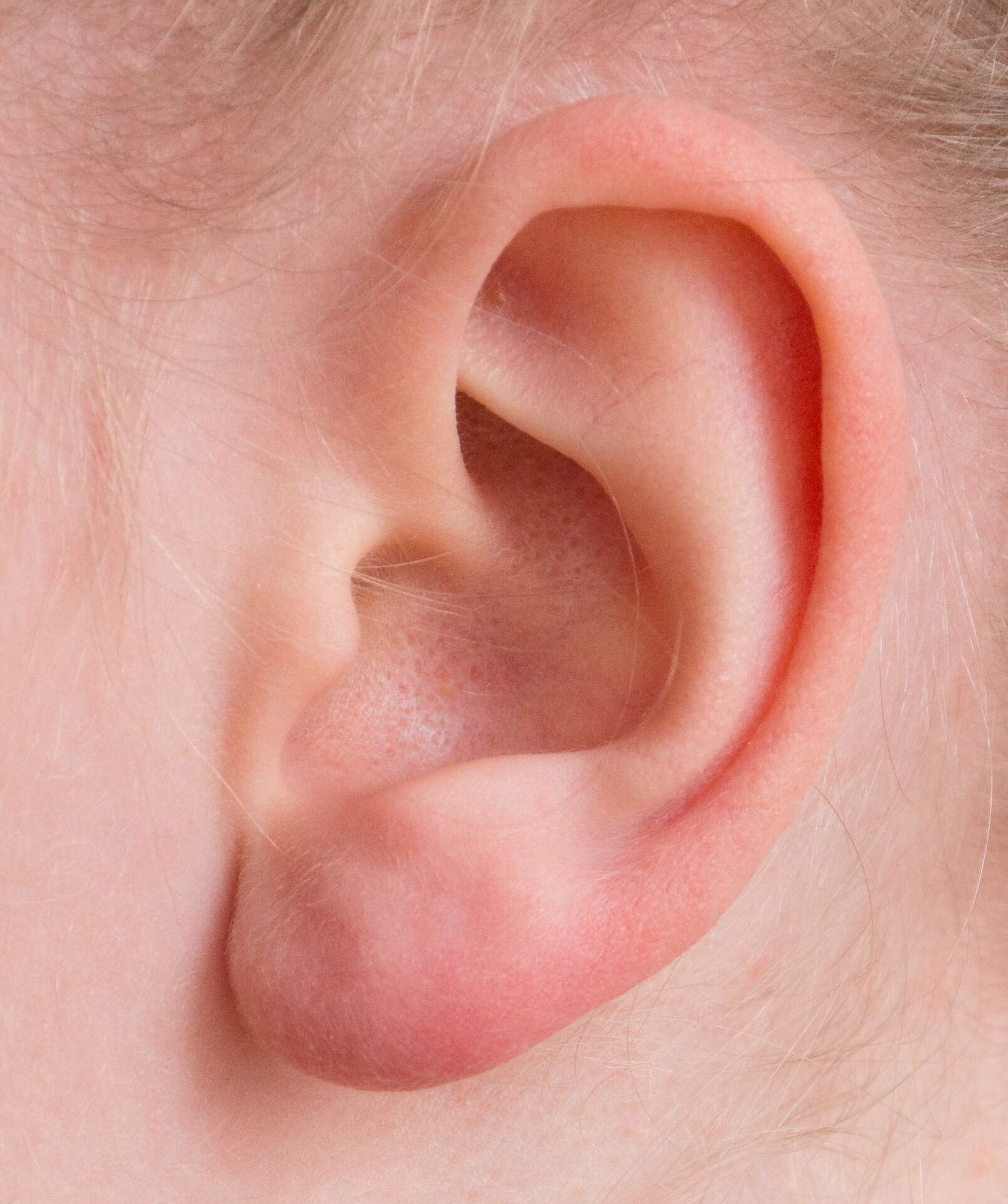 risks and benefits of ear tubes